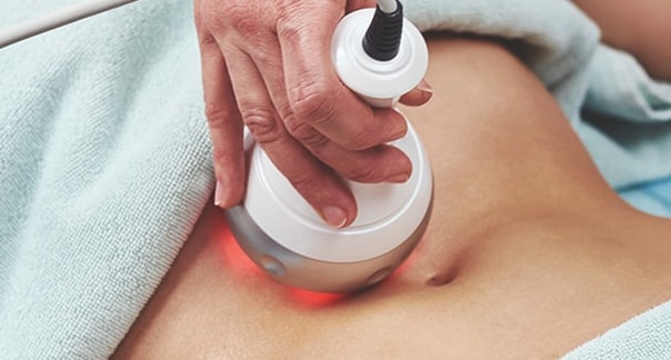 Radio Frequency for Non-surgical Liposuction