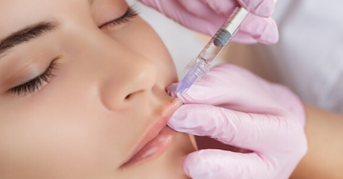 Needle lip filler injections